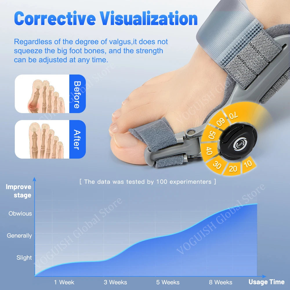 Unisex Bunion Corrector Splint: Big Toe Straightener for Hallux Valgus Relief - Orthopaedic Foot Care and Pain Alleviation